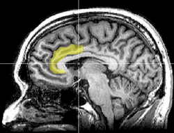 Representação esquemática das áreas corticais envolvidas na regulação da atenção